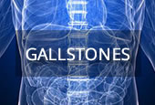 medical conditions gallstones