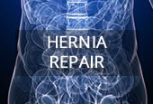 Upper GI surgery hernia repair