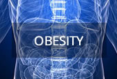 Upper GI surgery for obesity