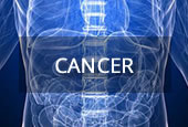 Upper GI surgery for bowel cancer stomach cancer and other cancer